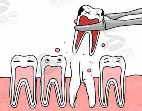 徐州看牙便宜又好的5家医院价格
