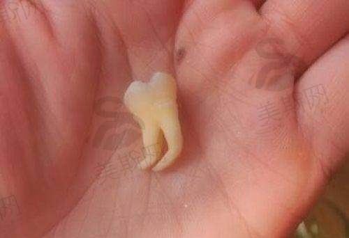 海门艾维口腔