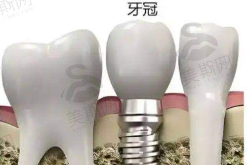 6、南通的口腔医院哪一家好？南通牙卫士口腔——德国技术设备集群，无牙颌种植骨干医生