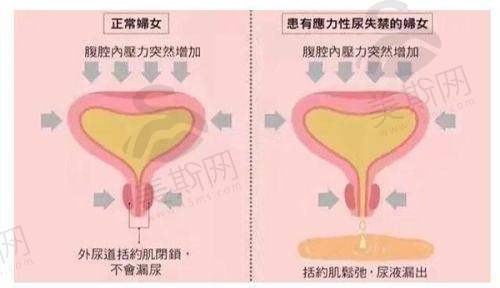 价格透明