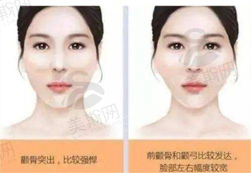 珠海九龙医院双眼皮成效探秘