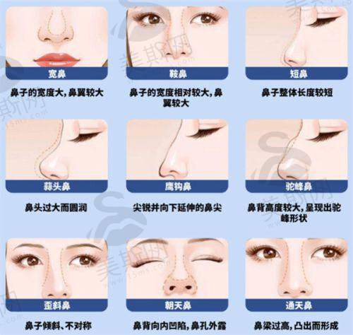 闭眼冲的理由