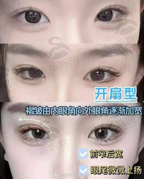 韩国珠儿丽Jewelry整形医院特色技术