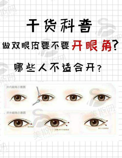韩国世美semi整形外科医院正规吗?
