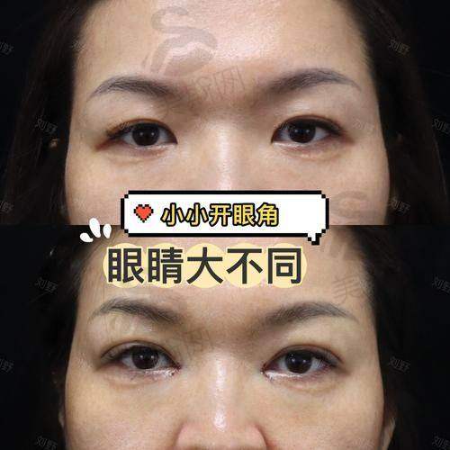 韩国清潭第一FIRST整形外科医院口碑如何