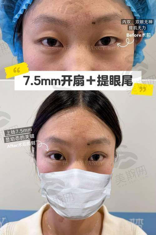 韩国清潭第一FIRST整形外科医院诊疗项目