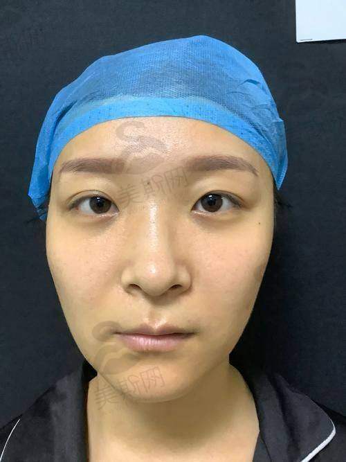 韩国必当归整形医院预约挂号