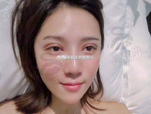 韩国清潭第一FIRST整形外科医院地址电话