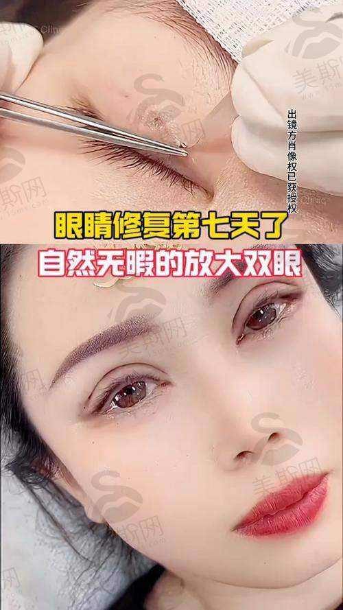 韩国Faceline整形外科医院诊疗项目