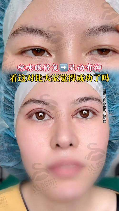 韩国清潭第一FIRST整形外科医院特色技术