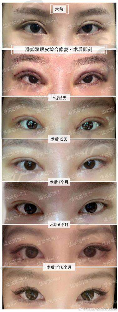 韩国赫拉(HERA)整形医院口碑如何