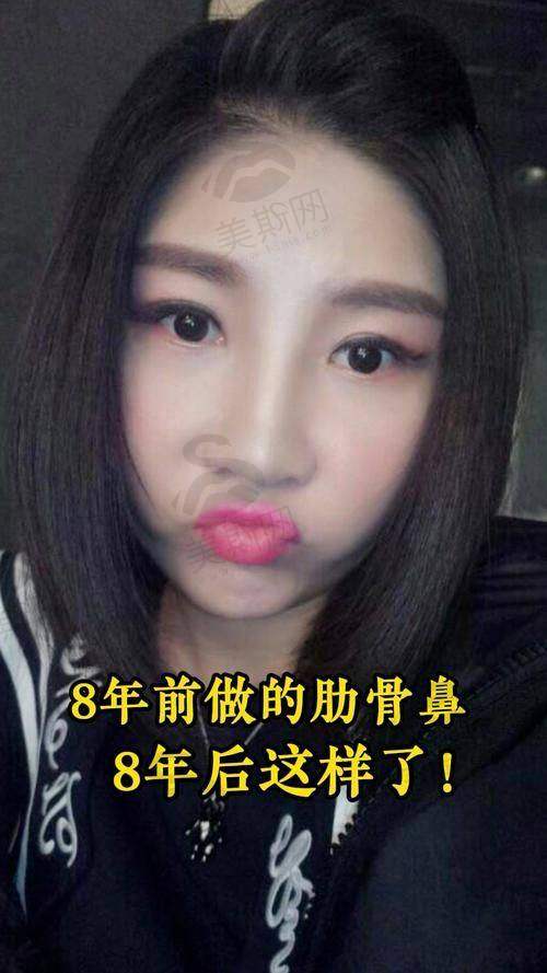 韩国Faceline整形外科医院口碑如何？