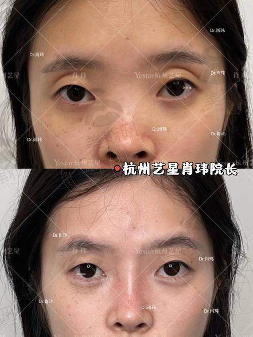 韩国世美semi整形外科医院口碑如何