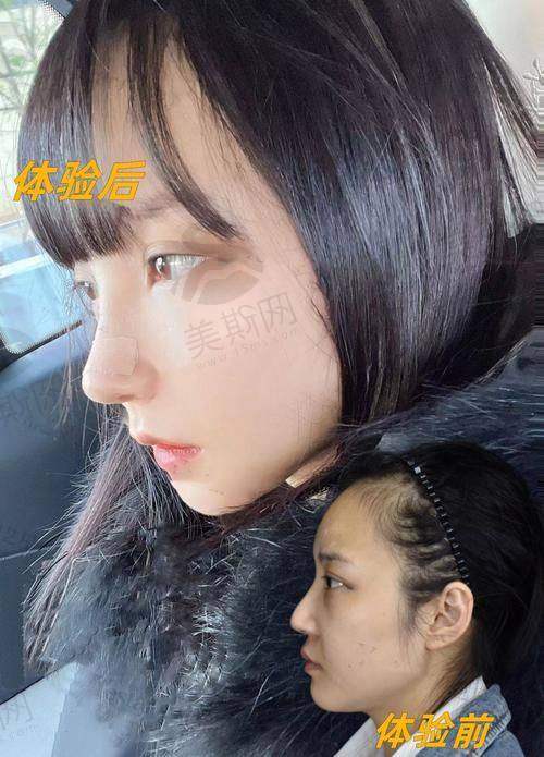 韩国可来熙Classy整形外科医院价格表
