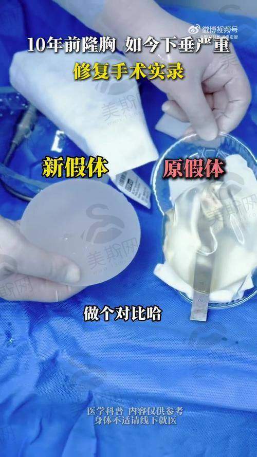 韩国MD整形医院怎么样?