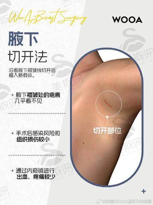 韩国MD整形医院特色技术