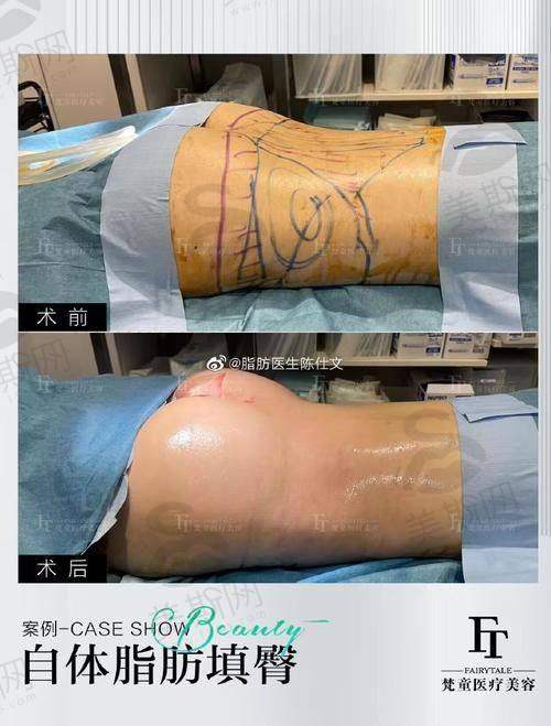 韩国365MC整形医院正规吗?