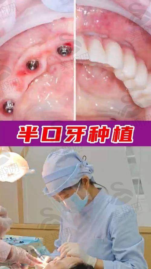 银川牙博士口腔悠悦城店医院特色技术