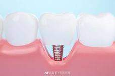 青海西宁中诺口腔医院诊疗项目