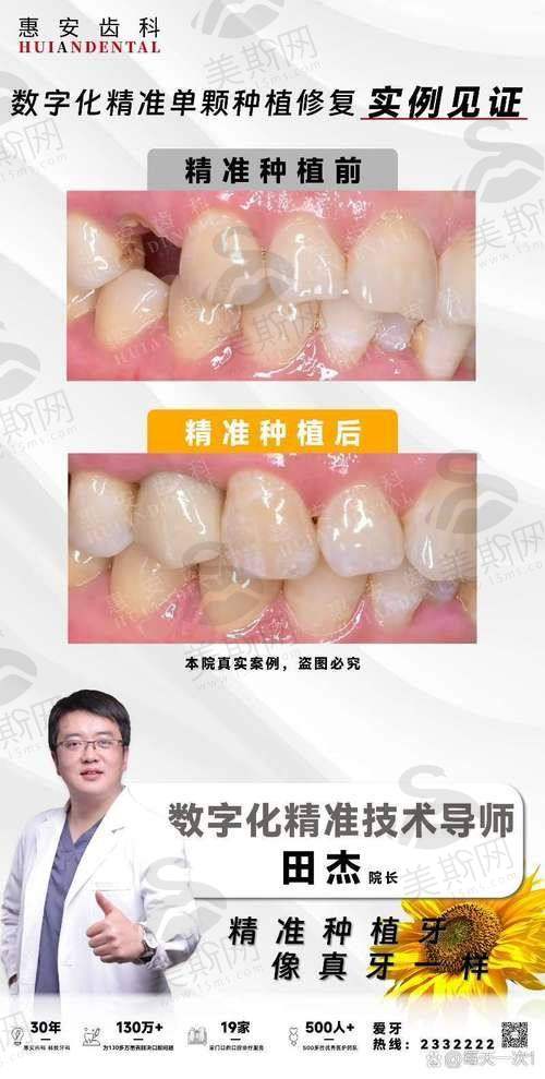 青海西宁中诺口腔医院特色技术