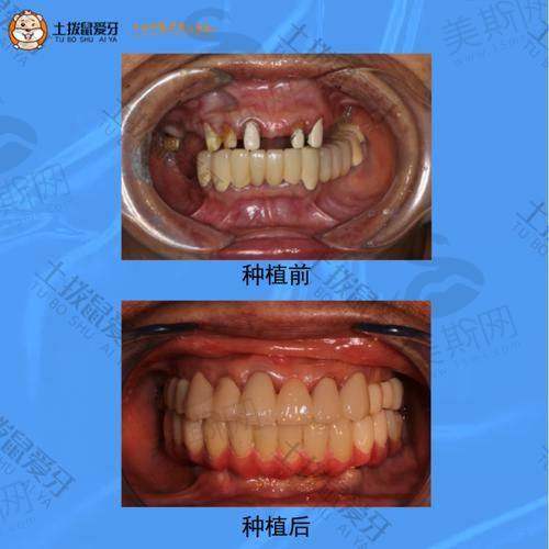 天津常乐口腔医院特色技术