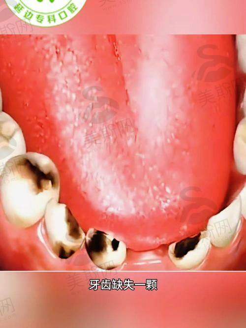 陕西汉中小虎牙口腔门诊部口碑如何