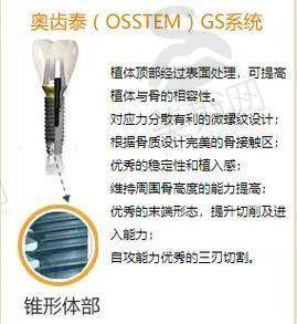 总结