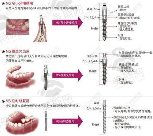 预约注意事项