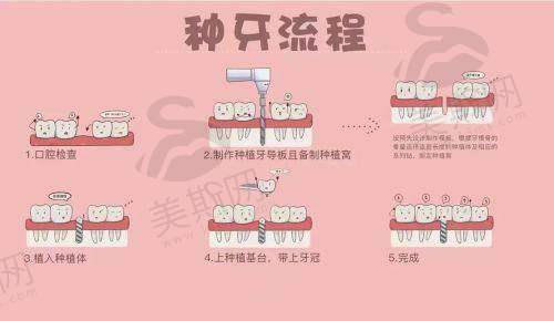 贵州贵阳柏乐口腔门诊部口碑如何