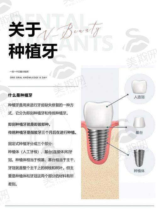 杭州美奥口腔特色技术