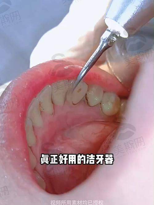 保定优戈正立口腔门诊诊疗项目