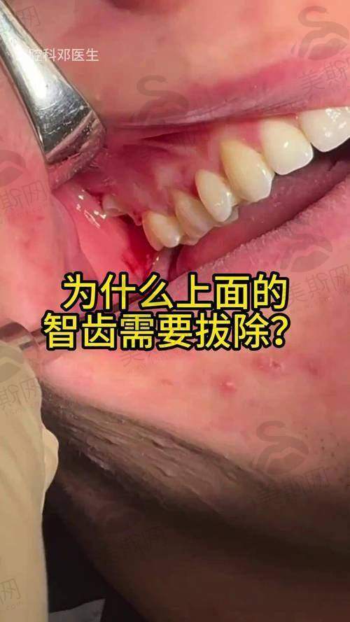 常州杜德轩牙士口腔医院价格表