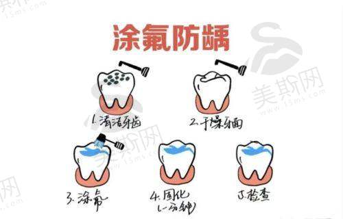 透明收费，性价比之选（以下价格为单项目参考，具体以面诊为准）