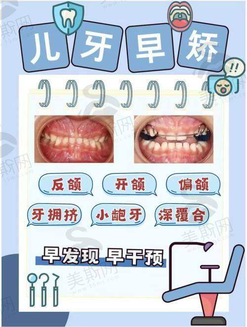 3. 网红正畸方案
