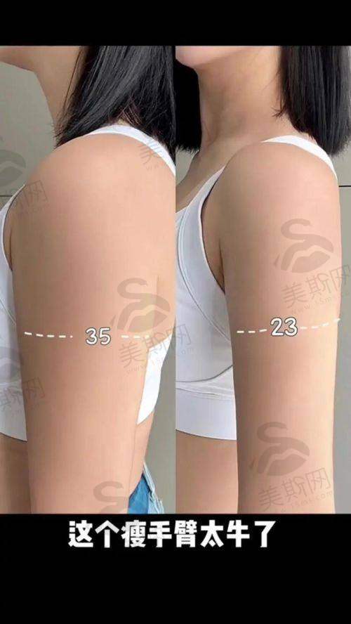 韩国365MC整形医院是国有的吗?