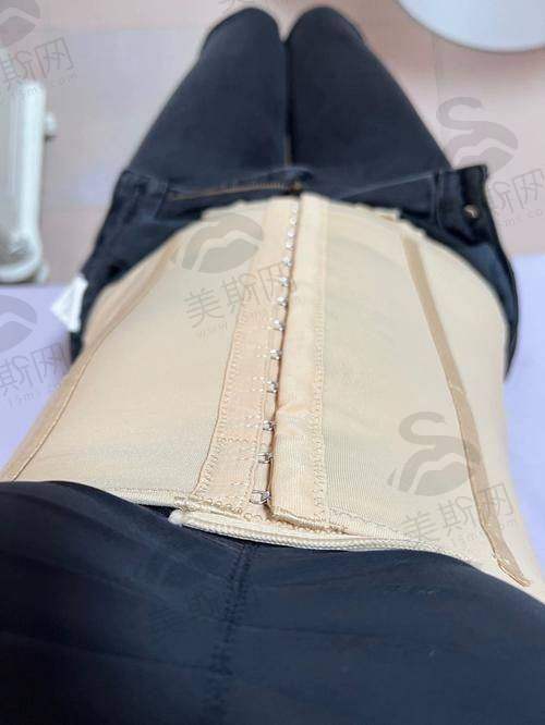 韩国365MC整形医院口碑如何