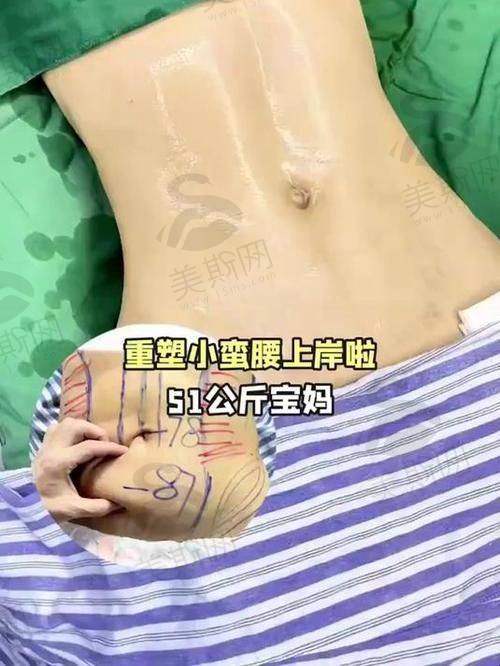 韩国365MC整形医院预约挂号