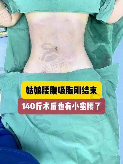 韩国普罗菲耳Profile整形医院是国有的吗？