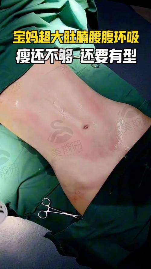 韩国普罗菲耳Profile整形医院怎么样？