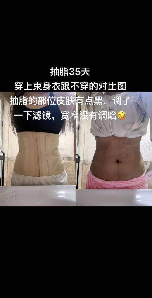 韩国明洞PPEUM丽芬聚医院怎么样？