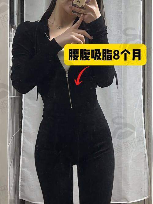 韩国普罗菲耳Profile整形医院特色技术