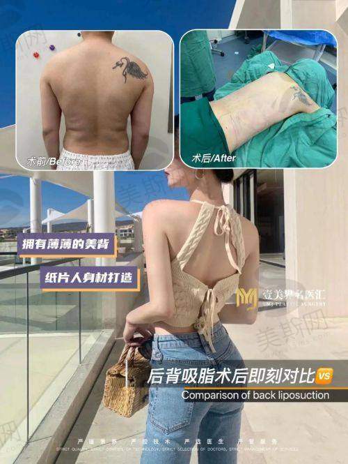 韩国365MC整形医院诊疗项目