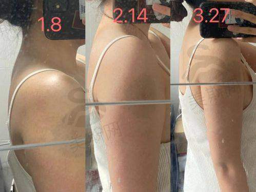 韩国365MC整形医院特色技术