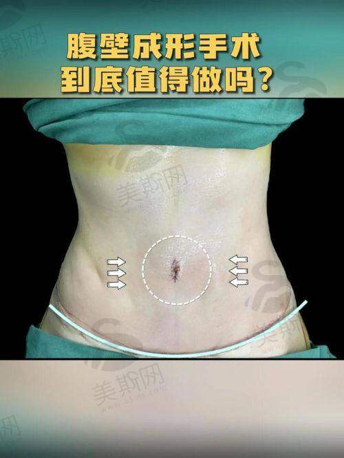 韩国必妩整形医院特色技术