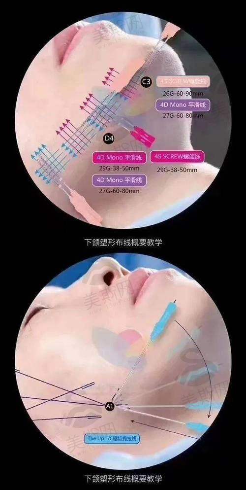 韩国姿飞JF抗老化医学美容中 心预约挂号