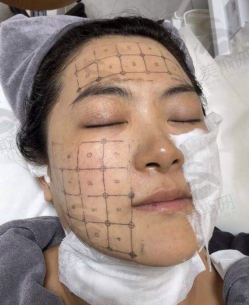 韩国必当归整形医院特色技术