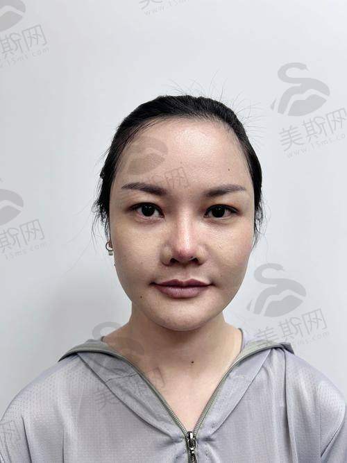 韩国姿飞JF抗老化医学美容中 心正规吗？