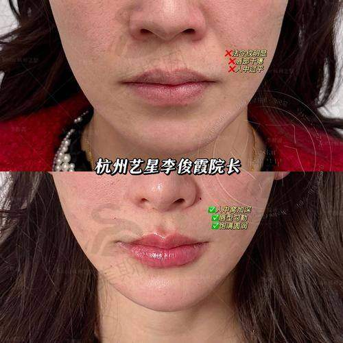 韩国赫拉(HERA)整形医院怎么样?