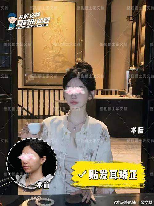 韩国普罗菲耳Profile整形医院正规吗？