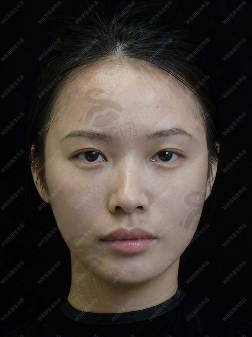 韩国必当归整形医院诊疗项目
